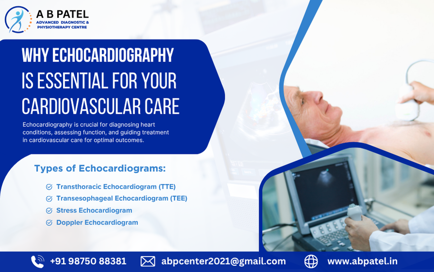 Why Echocardiography is Essential for Your Cardiovascular Care